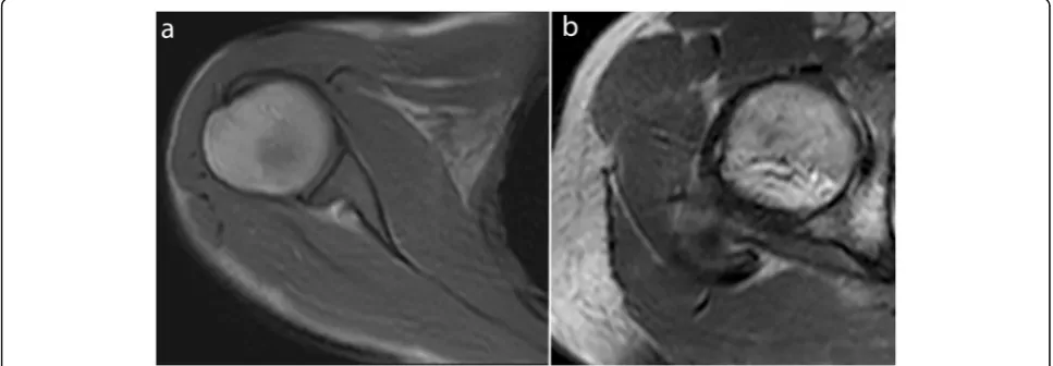 Fig. 1 Real-time dynamic MR images obtained with balanced SSFP sequence at 3.0 T. Shoulder in the axial plane in external rotation (in the axial plane in external rotation (a) and hipb) (TR, 4.2; TE, 2.1; flip angle, 40°; pixel size, 1.37 × 1.83 mm)