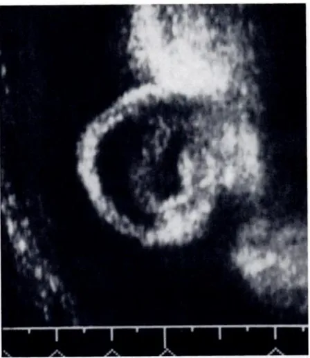 Fig 2.This29-mmlongearhasa roundedshape.