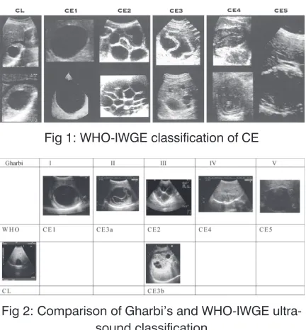 Fig 1: WHO-IWGE classification of CE