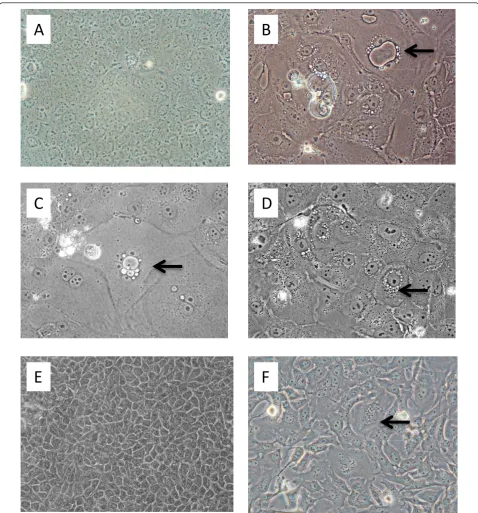 Figure 1 Microscopic analyses of cultured MDCK and Mv1 Lu cells. A. MDCK cells, normal (200× magnification); B