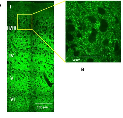 Figure 5  Pattern of Synaptophysin expression visualised using immunofluorescent labelling 