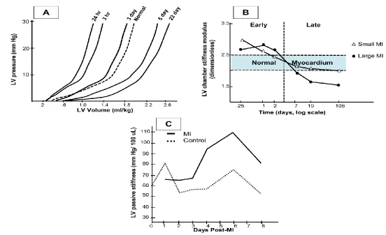 Figure 2.6 In-vivo chamber stiffness.  Summary of reported LV pressure-volume relationships with passive filling and derived calculations of chamber stiffness following MI