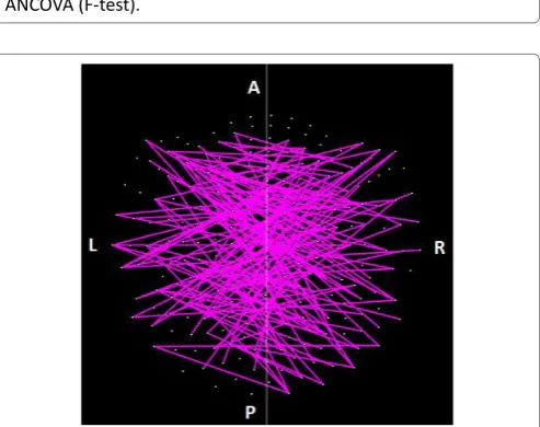 Figure 11: Lines indicate SNIs in the left and right hemisphere exceeding a nominal threshold of P < 0.01 (uncorrected) in the Control vs