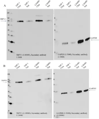 Figure ‎3-7: Secondary antibody (Santa Cruz Biotechnology) titration study. Two dilutions tested A: 1: 5000 or B: 1:10000 with 1:20000 of anti-TRPV1