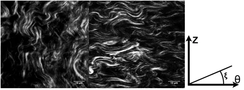 Figure 3.2: Representative second-harmonic generation images of thoracic aorta of apoE KO mouse on a chow diet (left) versus thoracic aorta of apoE KO mouse on Western diet (right)