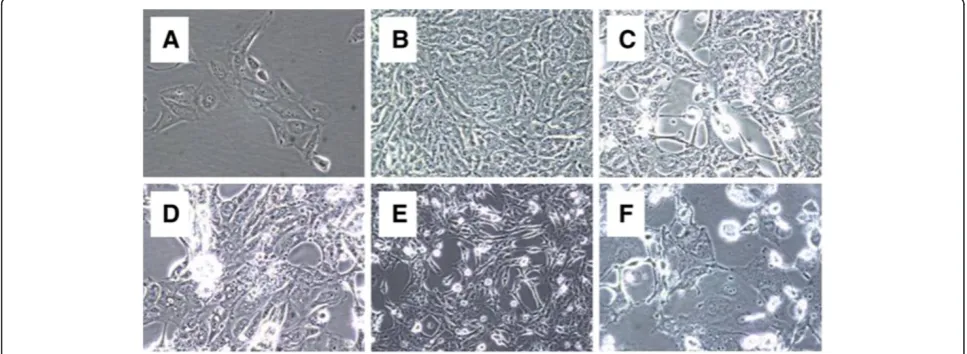 Figure 10 Cytopathic effects in a new batch of primary RPTEC infected with HCoV-NL63/RPTEC/2004 pp A and HCoV-NL63/2004 pp A, 3 dpi, 400x