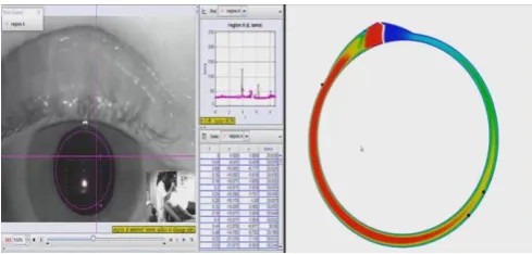 Figure 6 Analytical and numerical solution for cupula deformation for head manoeuvre from 0 to 120  