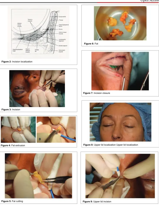 Figure 6: Fat