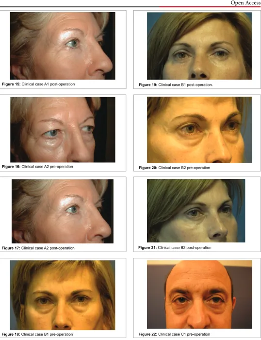 Figure 15: Clinical case A1 post-operation