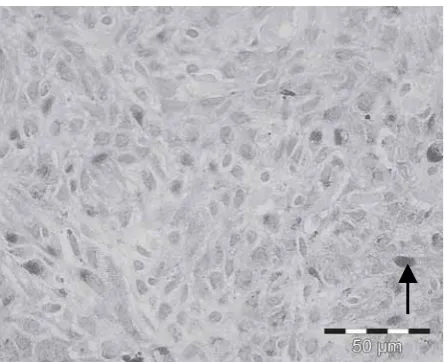 Fig 1: Immunostaining analysis of CCND1 in normal skin tissueillustrates the mild staining intensity (+1) in nuclei of normalepidermal cells (arrow)