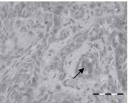 Fig 3: Immunostaining analysis shows nucleus and cytoplasmexpression of p16 protein using Tissue Microarray sample ofnormal skin tissue