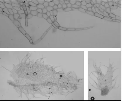 Figure 1. Leaf, underleaf and detail of leaf cilia of Schistochila ciliata (from MEL-301206)
