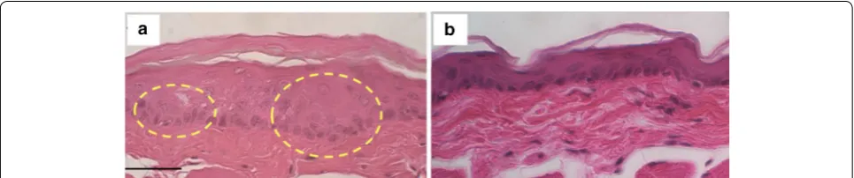 Fig. 6 H&E stained dysplastic hamster cheek pouch tissue topically administered with acid‑disassembling Au NCs (a) and normal hamster cheek pouch tissue (b)