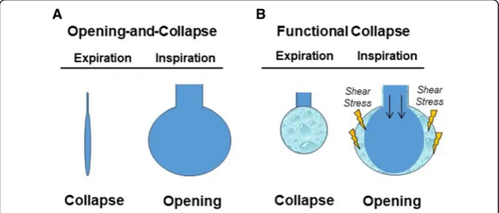 Fig. 4 Concepts of structural and functional opening and collapse of individual alveoli in injured lungs