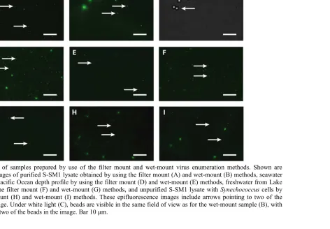Figure 2.2 Images of samples prepared by use of the filter mount and wet-mount virus enumeration methods