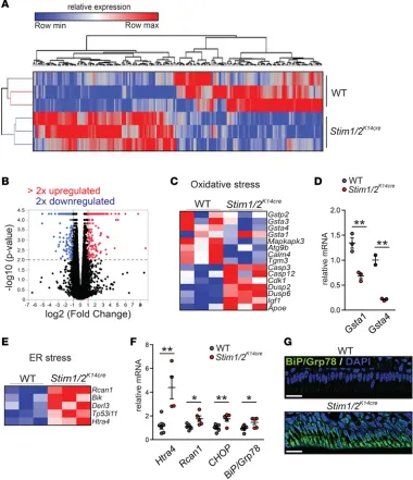 Figure 5. RNA sequencing of enamel organ cells in nofluorescence in maturation-stage ameloblasts