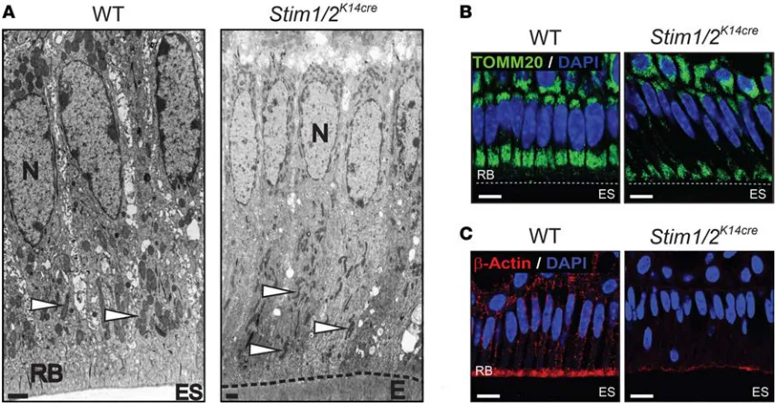 Figure 6. (rescence in maturation-stage ameloblasts of WT and blasts associated with loss of RB (N, nucleus; ES, enamel space; E, enamel)