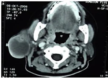 Figure 3: C.T. Scan displayed after the candidate answers the 1st question rightly at station No 2