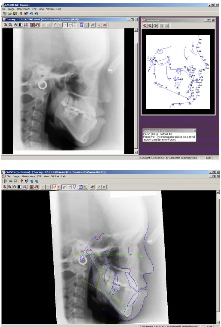 Figure 1.  Re-process and post-process X-ray image in CASSOS 
