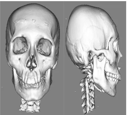 Figure 8.  Visualization of digitized skull 