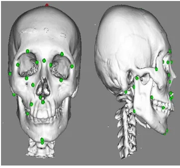 Figure 12 shows that the selected landmark is in a different 