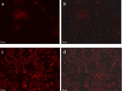 Figure 1.7. Fluorescent images (a, c) and overlay image with bright field (b, d) of HCT116 cell lines stained with 50 µM sensor 1 (upper level) and sensor 2 (lower level) for 0.5 h