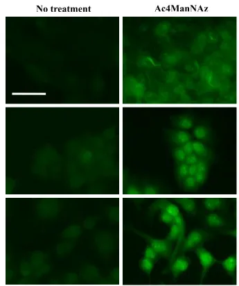 Figure 3.8. Staining of glycoprotein using DBCO-FL. MCF10A, MCF7 and MDA-MB-231 cells were incubated with 100 µM AC4ManNAz for 1 d