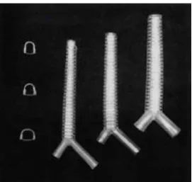 Figure 1.2. Examples of Freitag stent, in three different sizes (Freitag et al. 1994)
