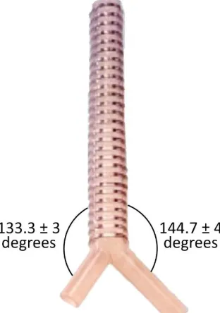 Figure 1.3. Shape profile of trachea. (a) Depiction of tracheal diameter change subjected to rigid and dynamic stents