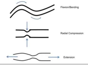 Figure 3.1. Some stent characterization tests. Angles of forces applied to stents during various standard tests that will determine maximal stress or strain the stent can withstand