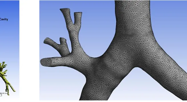 Fig. 1 - CT scan based Human Respiratory  Tract 