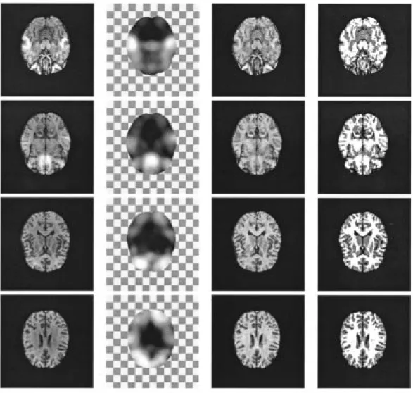Fig. 10. Four slices of a 3-D MR volume image with real bias field. In each row, from left to right: the original slice, the estimated bias field, the restored slice, and the segmentation.
