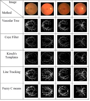Fig. 1 - Comparison of 5 different segmentation methods on retinal images.