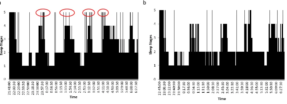 Fig. 2 - (a) Hypnogram of Primary Insomnia; (b) Hypnogram of Healthy Subject.  Sleep stages annotation 5 = Wake, 4 = REM, 3 = N1, 2 = N2, , 1 = N3