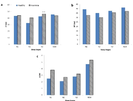 Fig. 3 - Mean plot of time indexes of HRV; (a) RRI; (b) SDNN; (c) RMSSD and (d) pNN50 in sleep stages N1, N2, N3 and REM