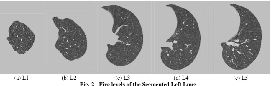 Fig. 3 - Overview of stages for lung disease classification. 