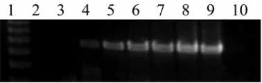 Fig. 3. Sensitivity of amplification of fungal DNA with primers ITS1-F and ITS4 with the addition of 25 fg of internal amplification control plasmid (IAC)to each 25-µl polymerase chain reaction