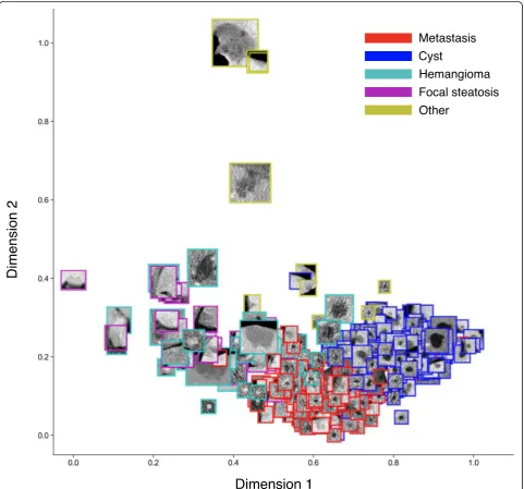 Fig. 5 Example of data visualization: projection on first two dimensions of linear discriminant analysis (LDA) applied to radiomics featuresextracted from various types of lesions [58]