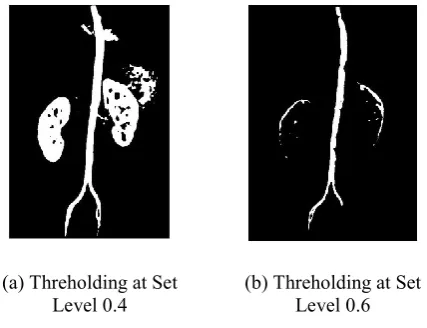 Figure 2.4: Block Diagram of Thresholding 