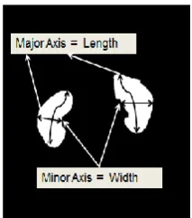 Table 1: Geometric measurement of Renal Size  (Manual Method) 