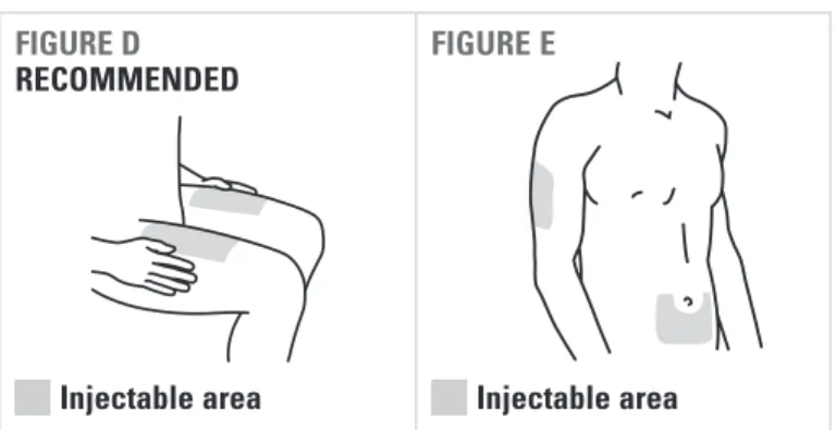 FIGURE D   RECOMMENDED