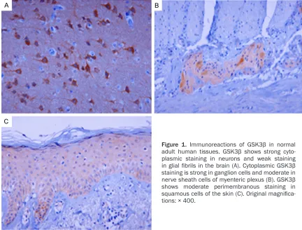 Figure 1. Immunoreactions of GSK3β in normal adult human tissues. GSK3β shows strong cyto-plasmic staining in neurons and weak staining in glial fibrils in the brain (A)
