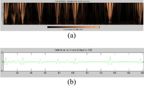 Fig 8 Result of CWT on abdominal signal position II, (a) Scalogram, (b) coefficient line