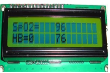 Fig 7. The Liquid Crystal Display (LCD) screen showing an example results 