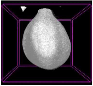 Figure 1: Lower abdominal (Pelvic) and the urinary bladder X-ray. (A) Plain antero-posterior view