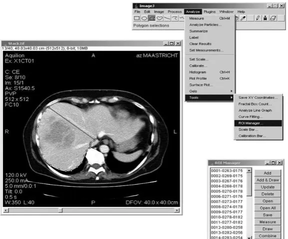 Figure 1: An interface of ImageJ software analysis 