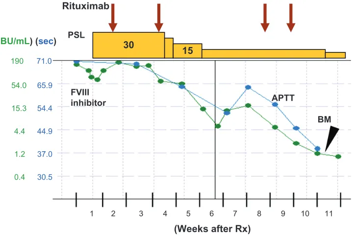 Table 1 The effect of prednisolone/rituximab on the FVIII activity, anti-FVIII inhibitor and neutrophil counts in a patient with AHA in association with CNL