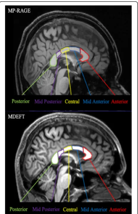 Table 1 Scanning parameters for 3D T1-weighted images:MP-RAGE and MDEFT pulse sequence at 3 T