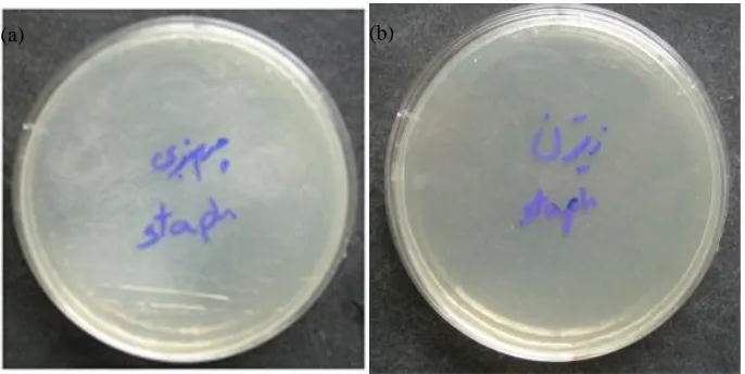 Figure 8:  Microbial cultivation in second method of a) goat leather sample with silver nanoparticles and b) cow leather with silver nanoparticles in presence of S