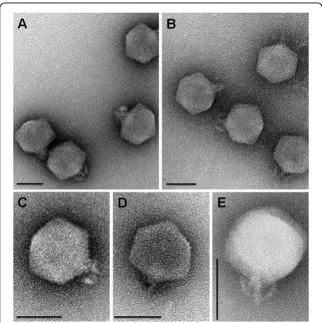 Figure 3 Identification of virion structural proteins of phagesϕJA1 and ϕVchO139-I. Proteins were separated on an 8-18%gradient SDS-PAGE (lane A- ϕJA-1 and lane B- ϕVchO139-I) andextracted from gel slices corresponding to specific bands andsubmitted for LC